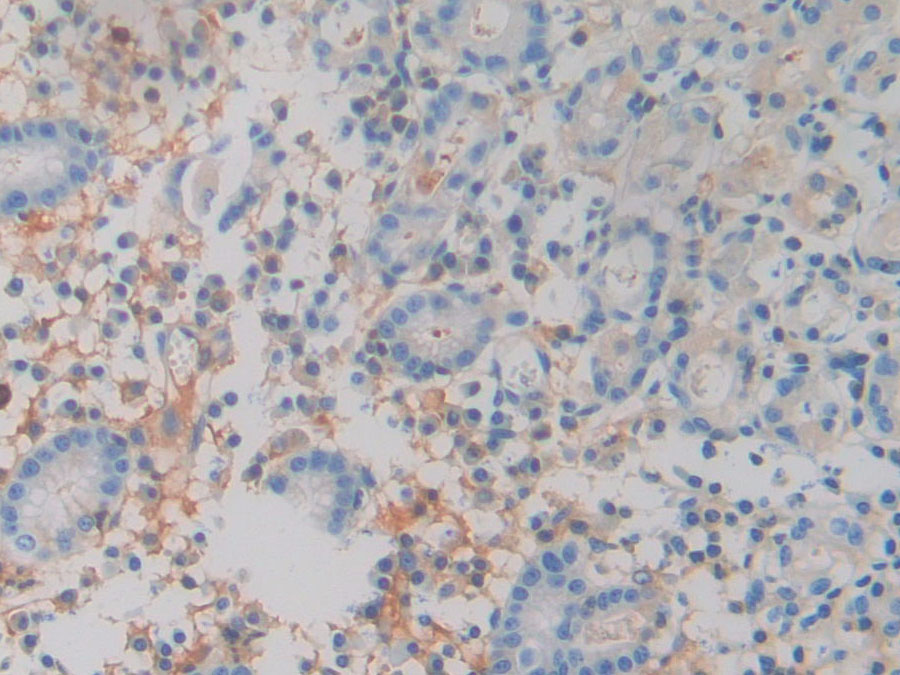 Biotin-Linked Polyclonal Antibody to Lipocalin 15 (LCN15)