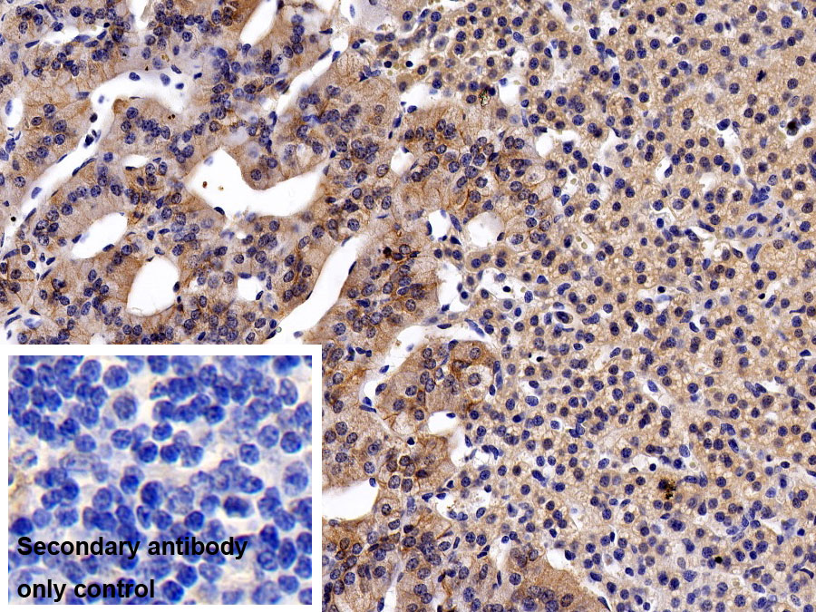 Monoclonal Antibody to Activated Leukocyte Cell Adhesion Molecule (ALCAM)