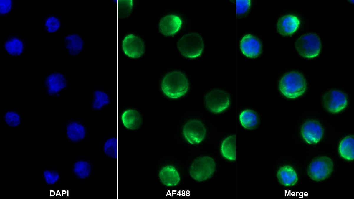 Monoclonal Antibody to Activated Leukocyte Cell Adhesion Molecule (ALCAM)