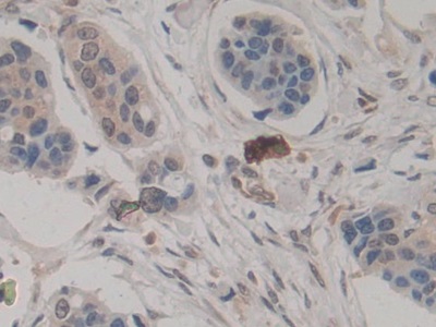 Monoclonal Antibody to Amphiregulin (AREG)