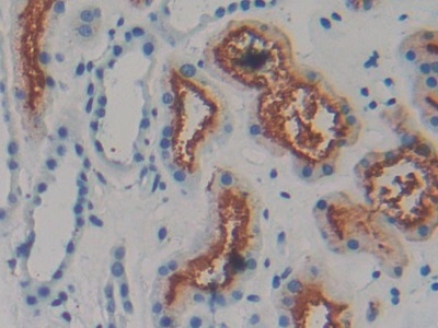 Monoclonal Antibody to Amphiregulin (AREG)