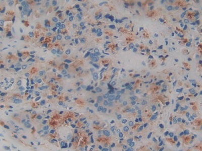 Monoclonal Antibody to Amphiregulin (AREG)