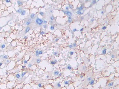 Monoclonal Antibody to Amphiregulin (AREG)