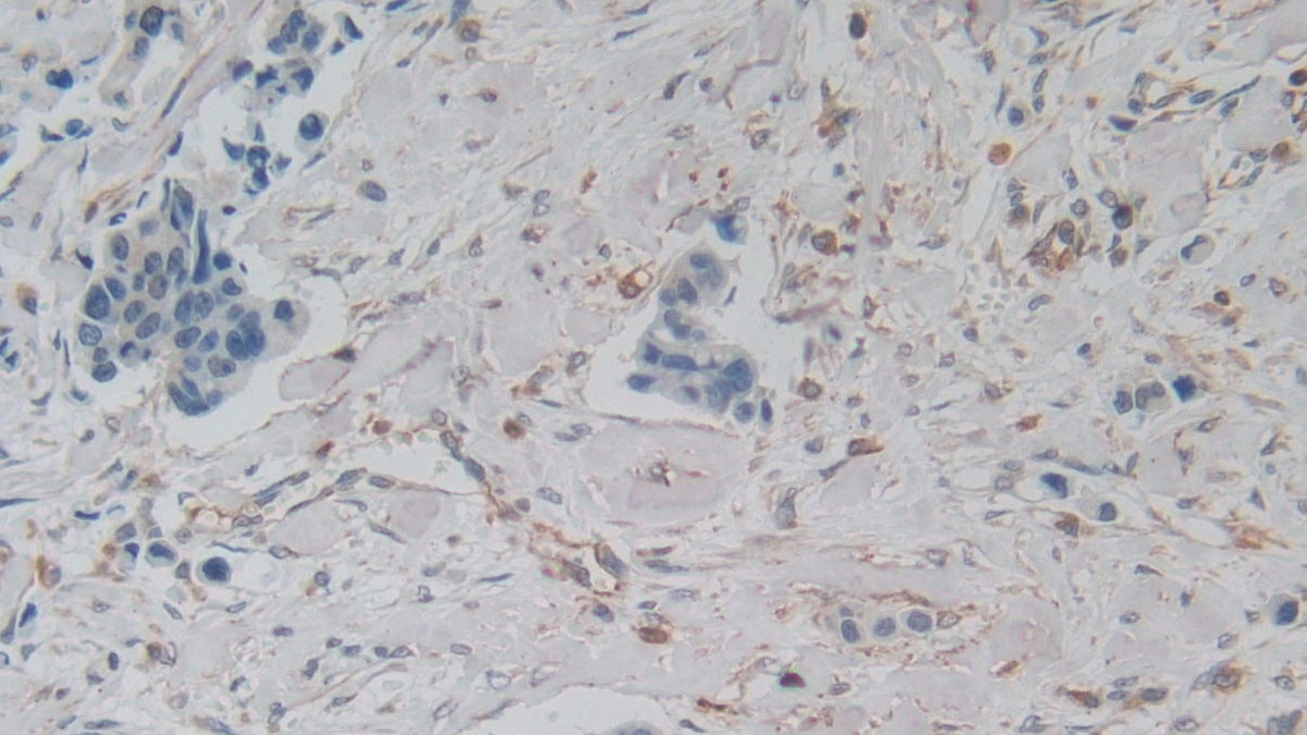 Monoclonal Antibody to Amphiregulin (AREG)