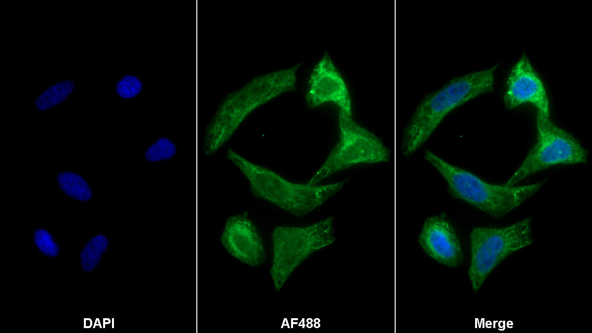 Monoclonal Antibody to Connective Tissue Growth Factor (CTGF)