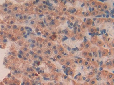 Monoclonal Antibody to Connective Tissue Growth Factor (CTGF)