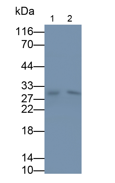 Monoclonal Antibody to Brain Derived Neurotrophic Factor (BDNF)