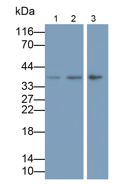 Monoclonal Antibody to Brain Derived Neurotrophic Factor (BDNF)