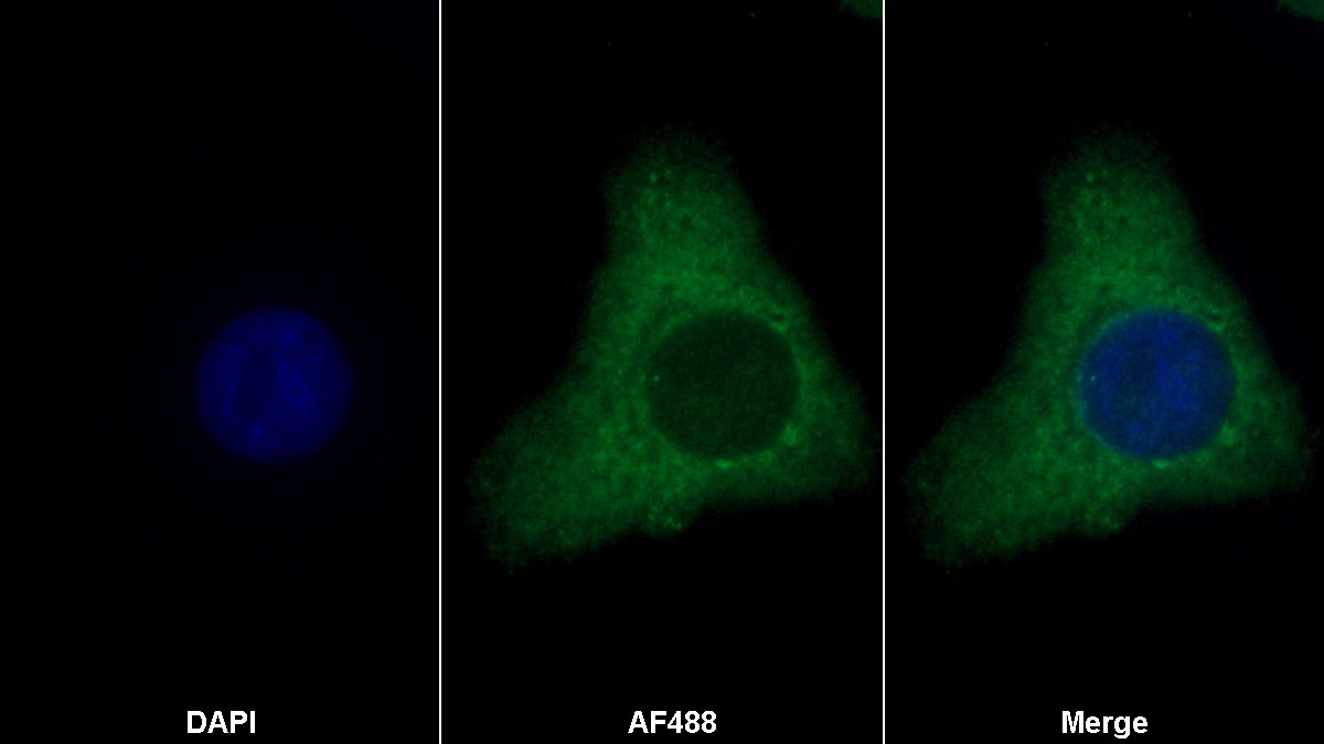 Monoclonal Antibody to Brain Derived Neurotrophic Factor (BDNF)