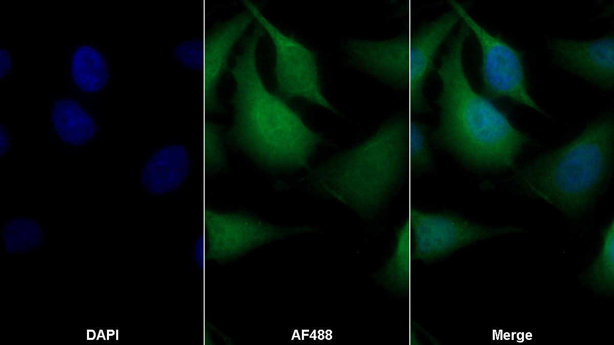 Monoclonal Antibody to S100 Calcium Binding Protein (S100)