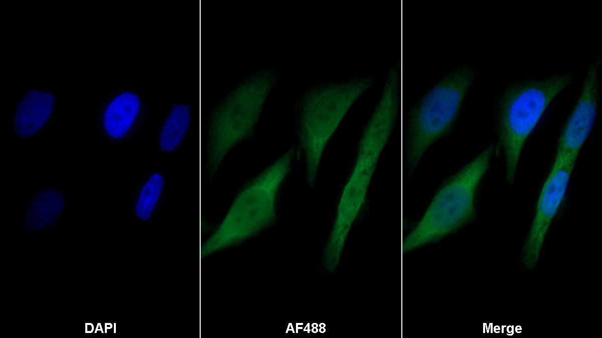 Monoclonal Antibody to S100 Calcium Binding Protein (S100)