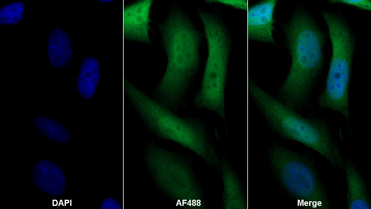 Monoclonal Antibody to S100 Calcium Binding Protein (S100)