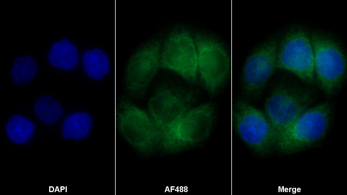 Monoclonal Antibody to E-cadherin