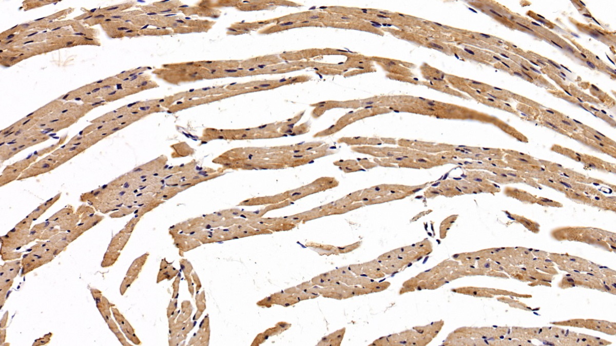 Monoclonal Antibody to Erythropoietin Receptor (EPOR)