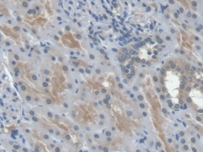 Monoclonal Antibody to Erythropoietin (EPO)