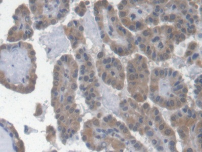 Monoclonal Antibody to Erythropoietin (EPO)