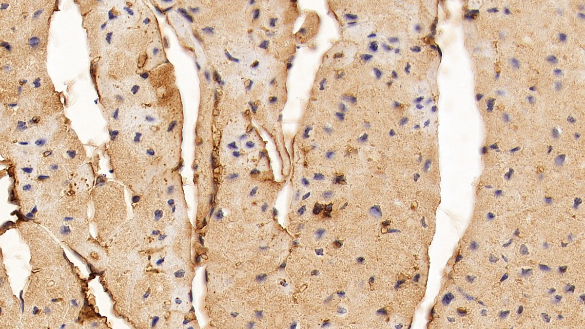 Monoclonal Antibody to Fibroblast Growth Factor 1, Acidic (FGF1)