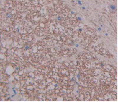 Monoclonal Antibody to Fibroblast Growth Factor 1, Acidic (FGF1)