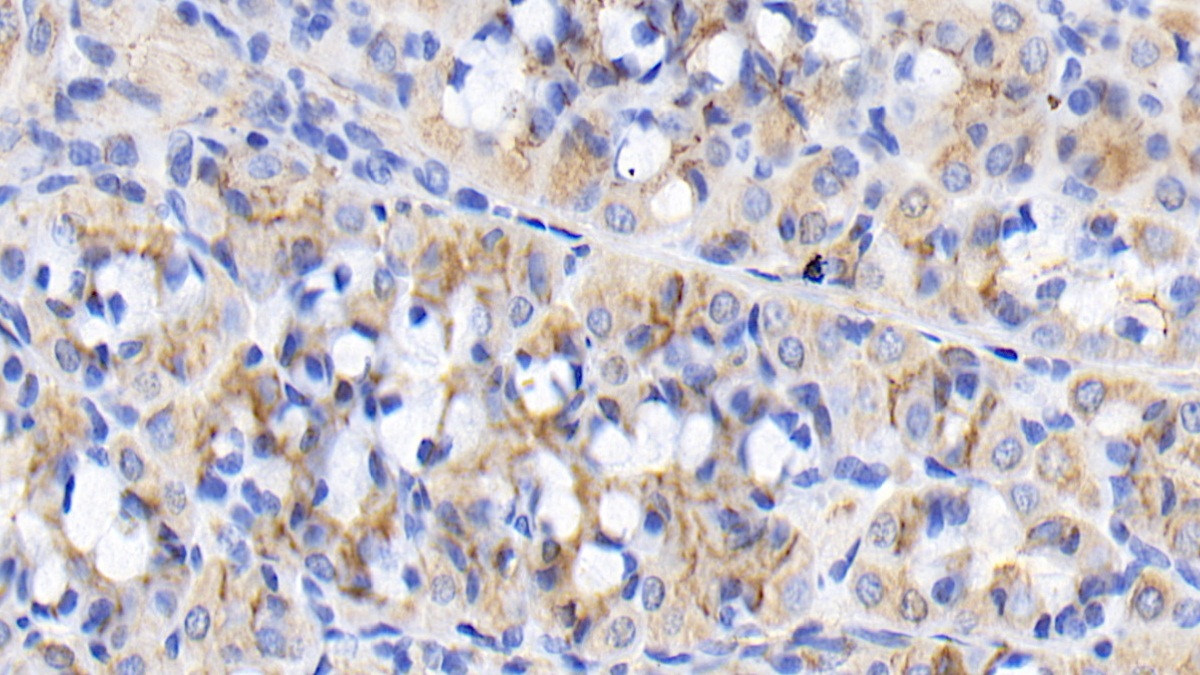 Monoclonal Antibody to Fibroblast Growth Factor 9 (FGF9)