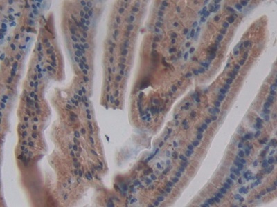 Monoclonal Antibody to Chemokine (C-X-C Motif) Ligand 1 (CXCL1)