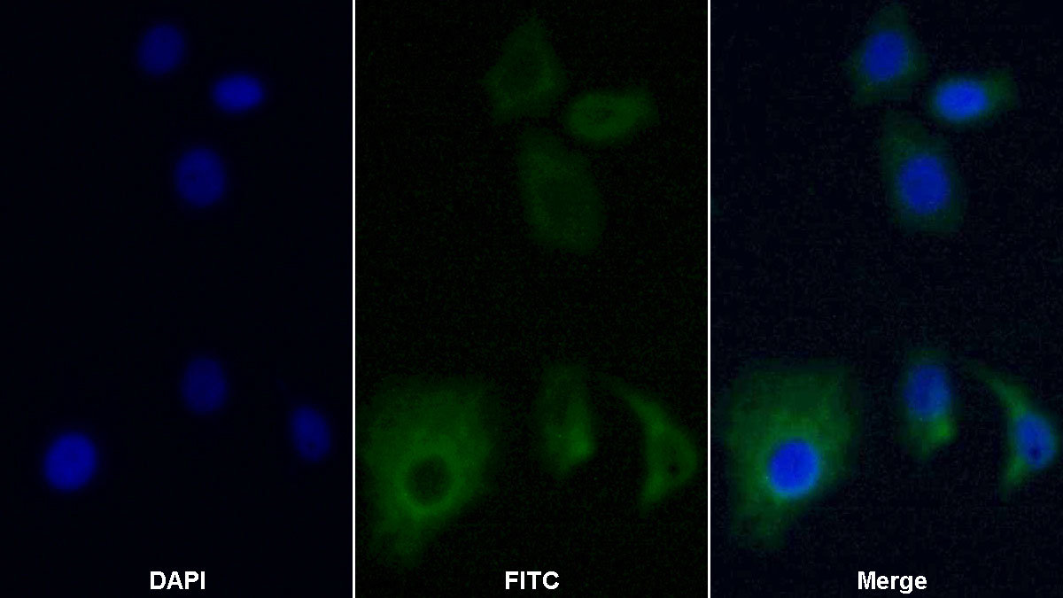 Monoclonal Antibody to Insulin Like Growth Factor 1 (IGF1)