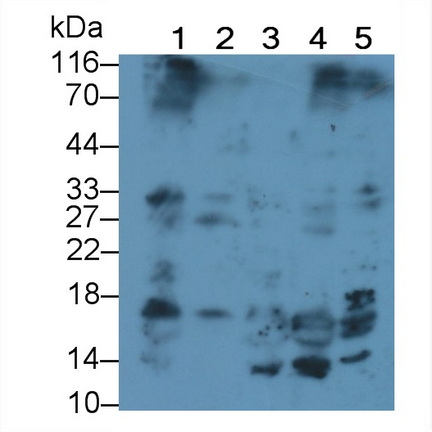 Monoclonal Antibody to Insulin Like Growth Factor 1 (IGF1)