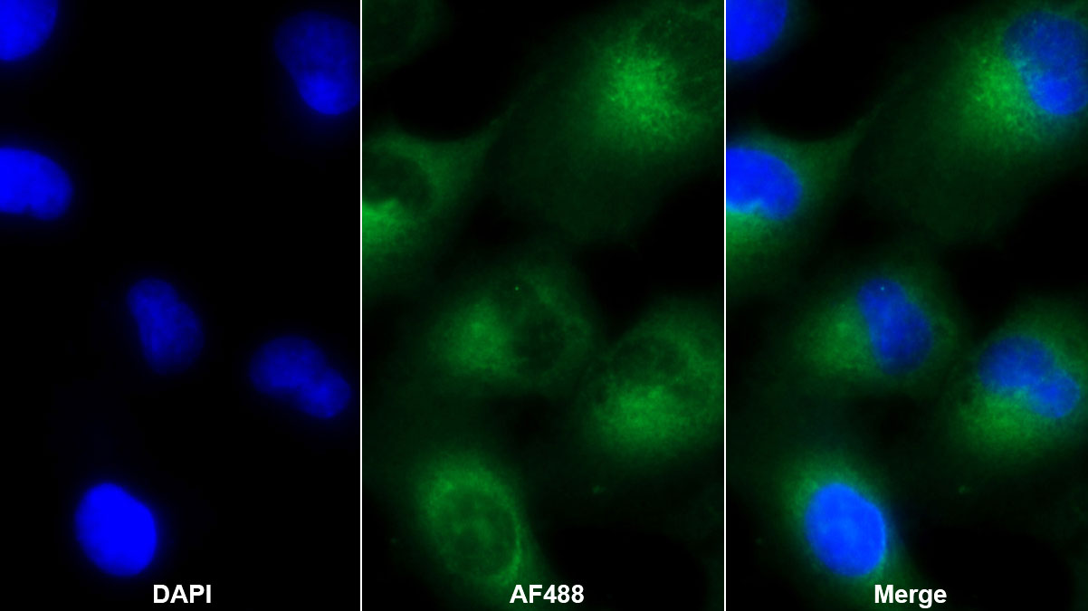 Monoclonal Antibody to Insulin Like Growth Factor Binding Protein 1 (IGFBP1)