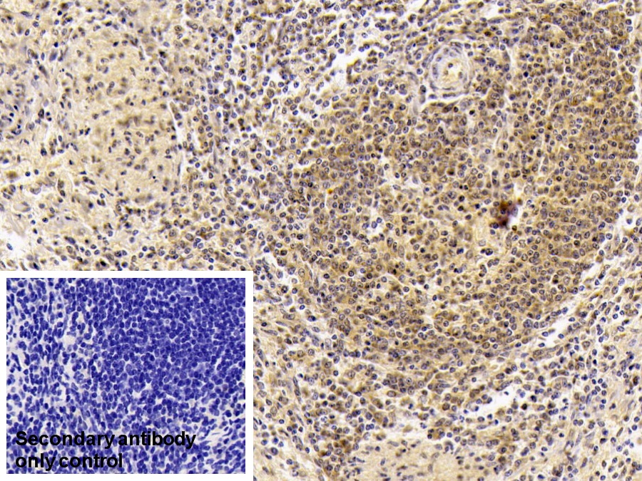 Monoclonal Antibody to Insulin Like Growth Factor Binding Protein 1 (IGFBP1)