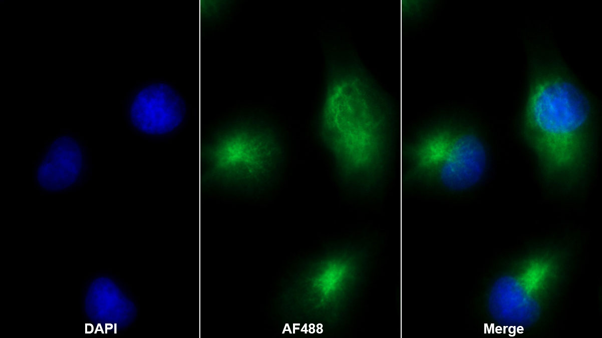 Monoclonal Antibody to Insulin Like Growth Factor Binding Protein 1 (IGFBP1)