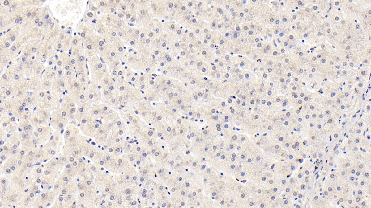 Monoclonal Antibody to Insulin Like Growth Factor Binding Protein 3 (IGFBP3)