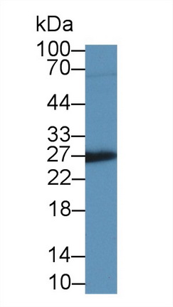 Monoclonal Antibody to Insulin Like Growth Factor Binding Protein 4 (IGFBP4)