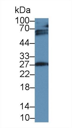 Monoclonal Antibody to Insulin Like Growth Factor Binding Protein 4 (IGFBP4)