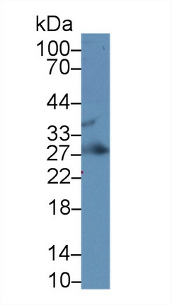 Monoclonal Antibody to Insulin Like Growth Factor Binding Protein 4 (IGFBP4)