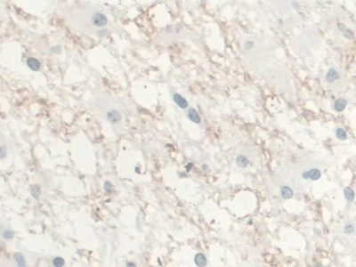 Monoclonal Antibody to Interleukin 10 (IL10)