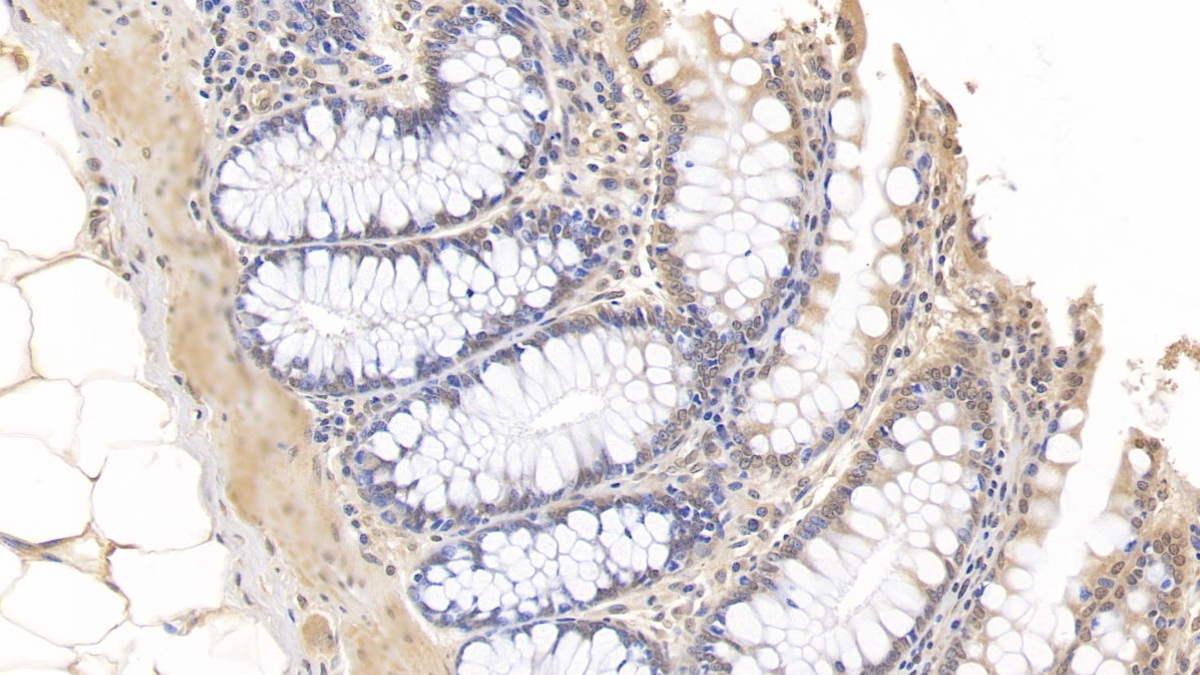 Monoclonal Antibody to Interleukin 10 (IL10)