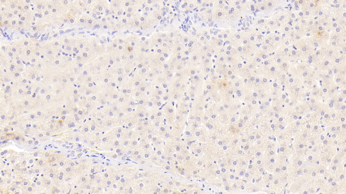 Monoclonal Antibody to Interleukin 12B (IL12B)