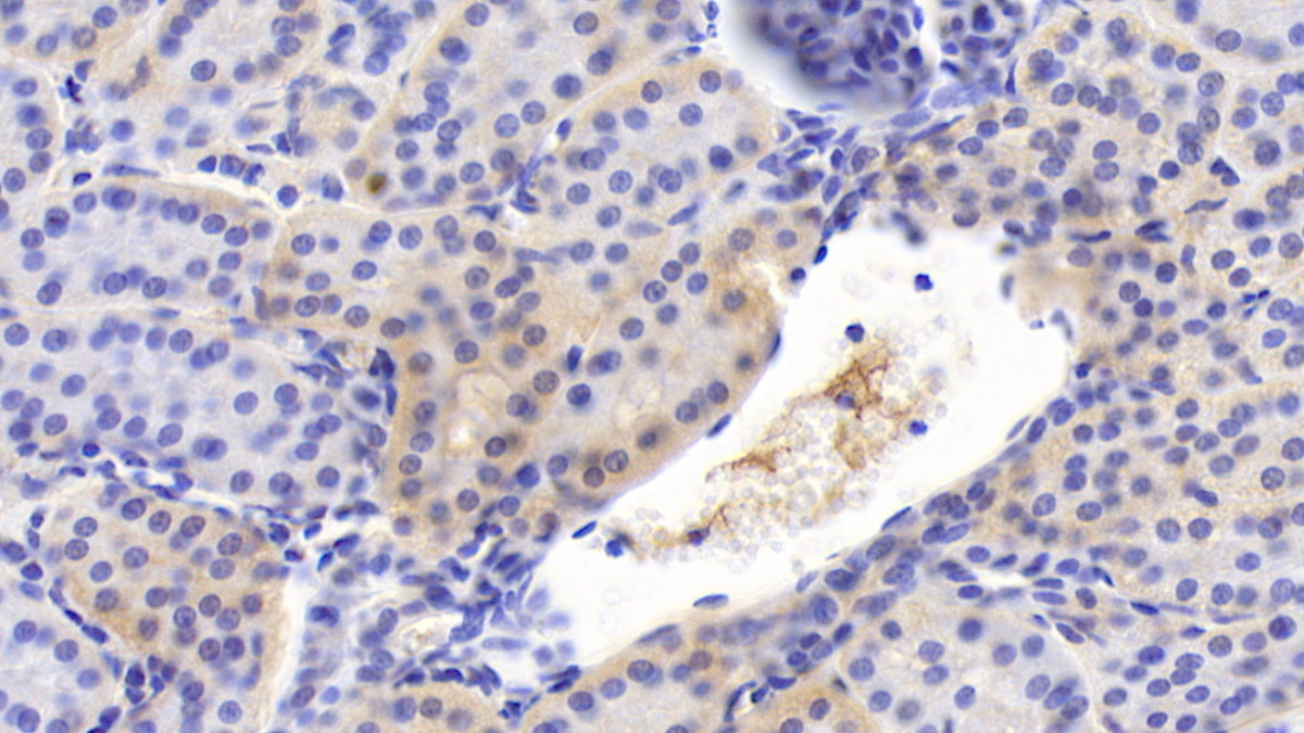 Monoclonal Antibody to Interleukin 12B (IL12B)