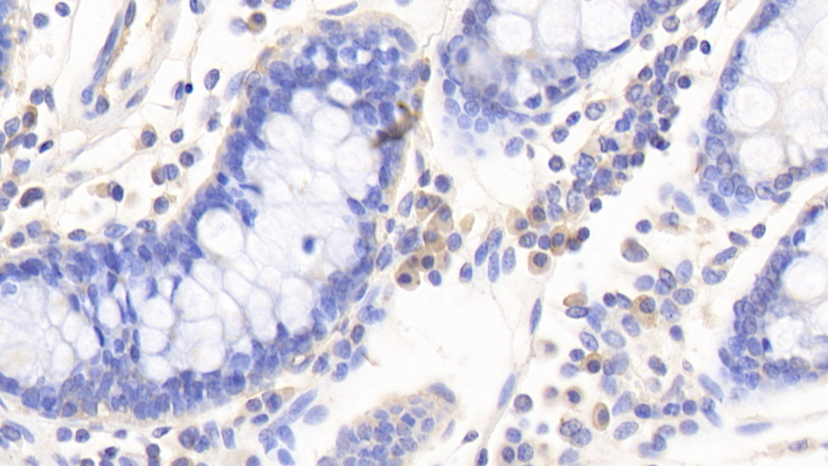 Monoclonal Antibody to Interleukin 12B (IL12B)