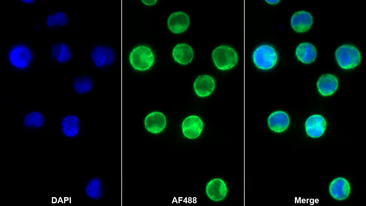 Monoclonal Antibody to Interleukin 12B (IL12B)