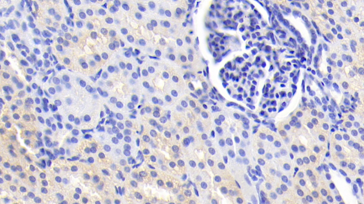 Monoclonal Antibody to Interleukin 12B (IL12B)