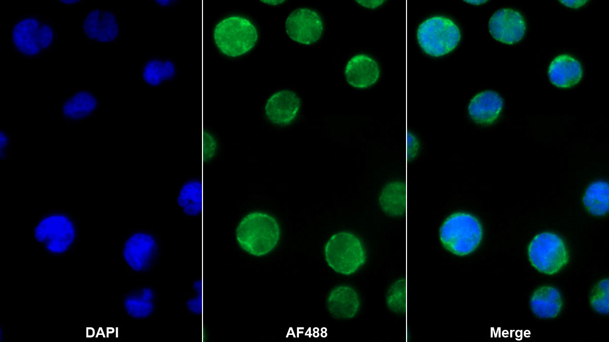 Monoclonal Antibody to Interleukin 12B (IL12B)