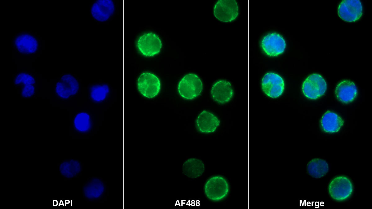 Monoclonal Antibody to Interleukin 12B (IL12B)