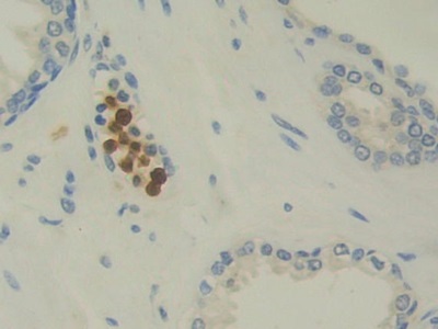 Monoclonal Antibody to Interleukin 12A (IL12A)