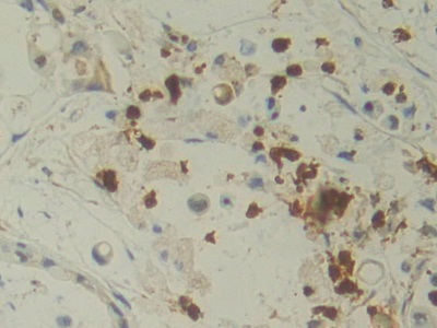 Monoclonal Antibody to Interleukin 12A (IL12A)