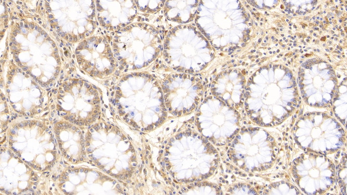 Monoclonal Antibody to Interleukin 17 (IL17)