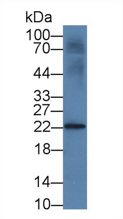 Monoclonal Antibody to Interleukin 18 (IL18)