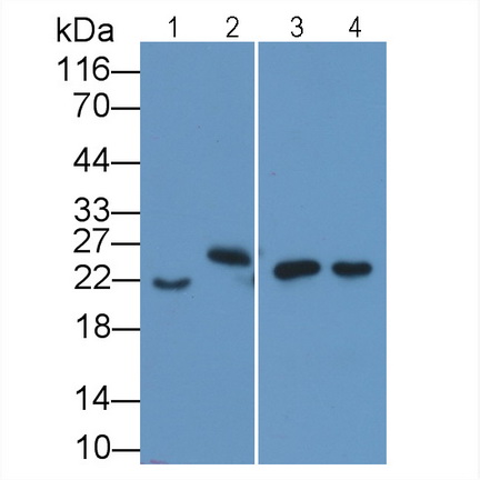 Monoclonal Antibody to Interleukin 18 (IL18)