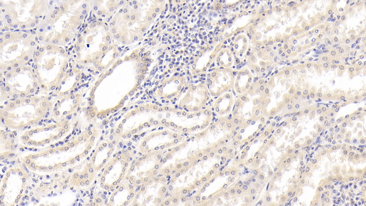 Monoclonal Antibody to Interleukin 18 (IL18)