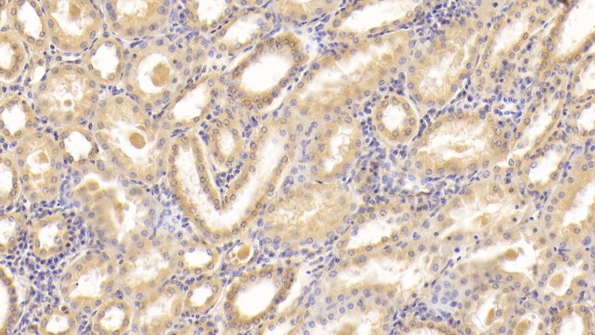 Monoclonal Antibody to Interleukin 18 (IL18)