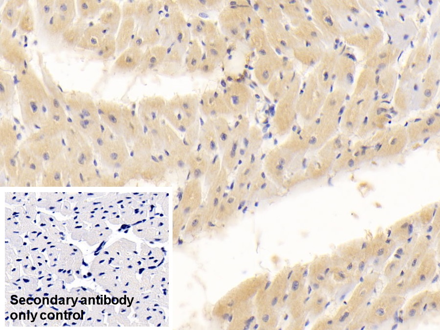 Monoclonal Antibody to Interleukin 18 (IL18)